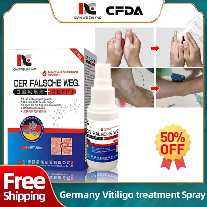 Germany Vitiligo Treatment Medicine Spray Skin White Spot Remover Leukoplakia Removal Leg Brown Spots Repair Promote Melanin