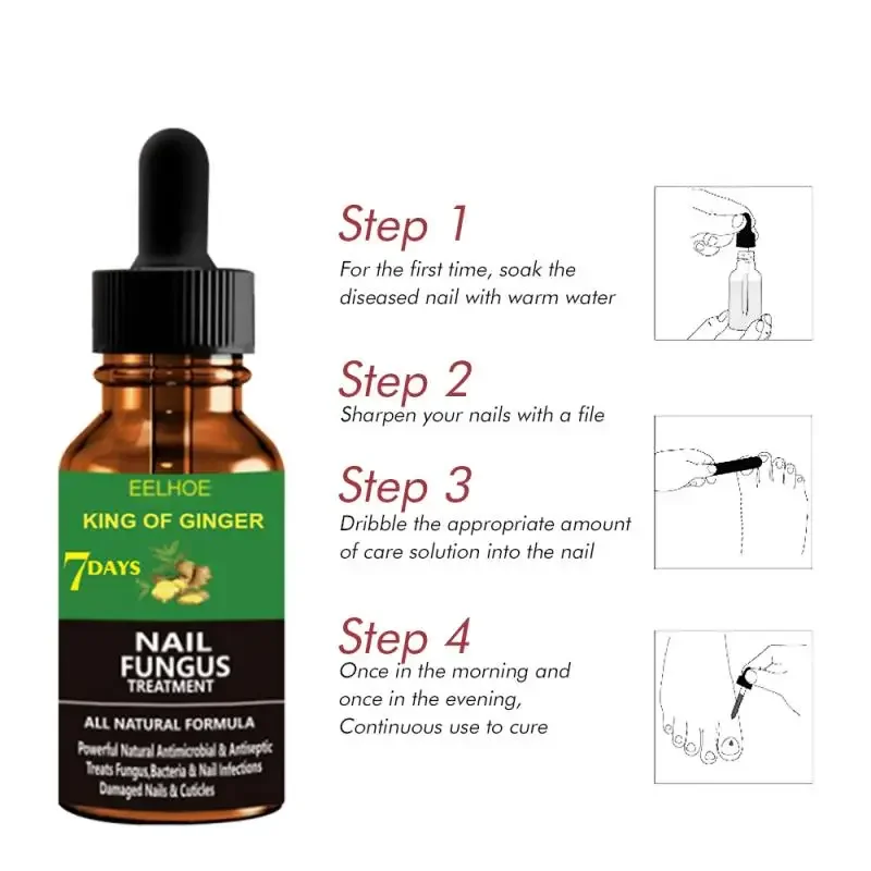 7DAYS Fungal Nail Treatment Essence Oil Anti-Fungus Onychomycosis-Removal Liquid Ginger Foot Antifungal Nail Treatments 30ml