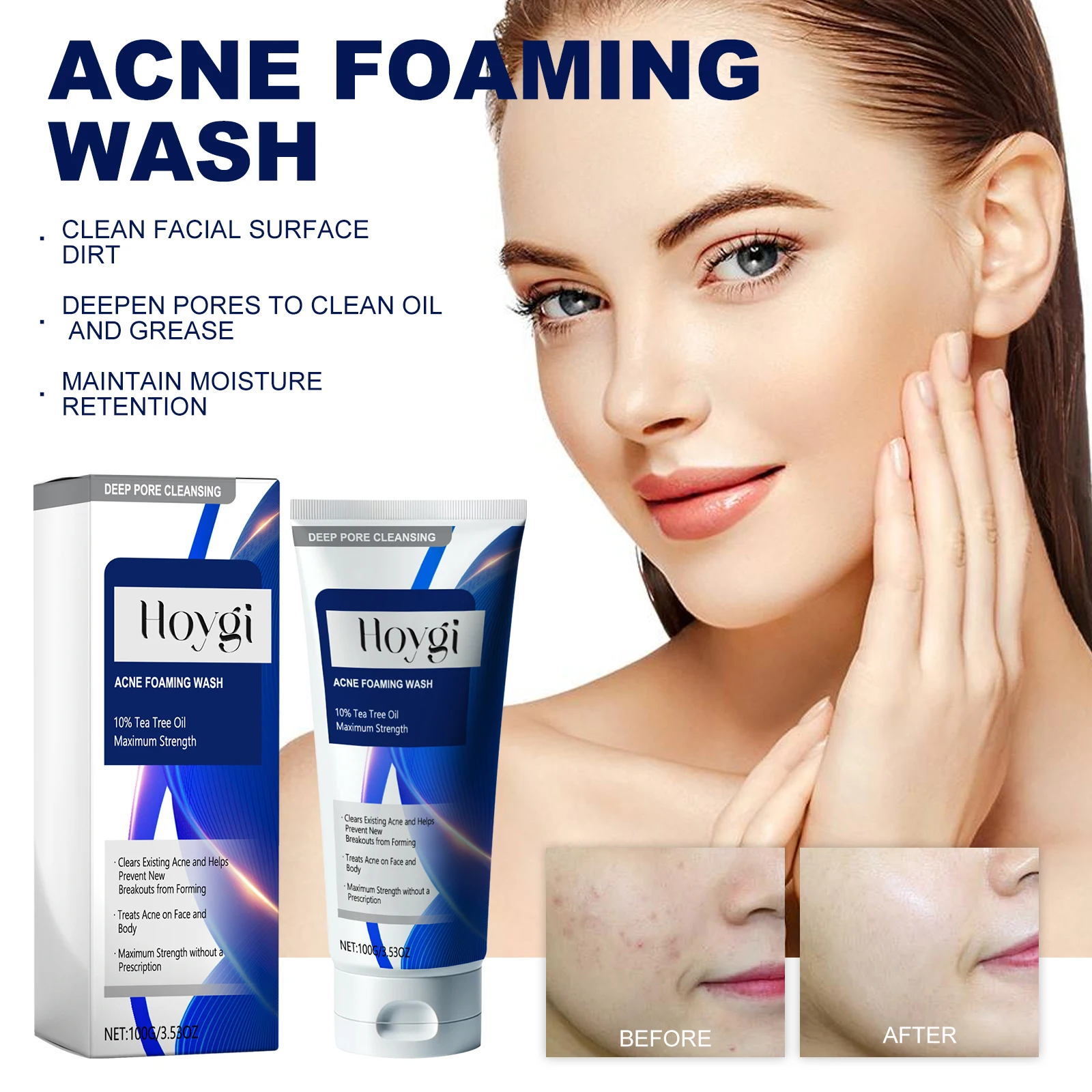 

Очищающее средство для лица против прыщей, контроль жирности, средство для удаления черных точек, сужение пор, глубокое очищение, лечение прыщей, увлажняющее средство для умывания лица, 100 г