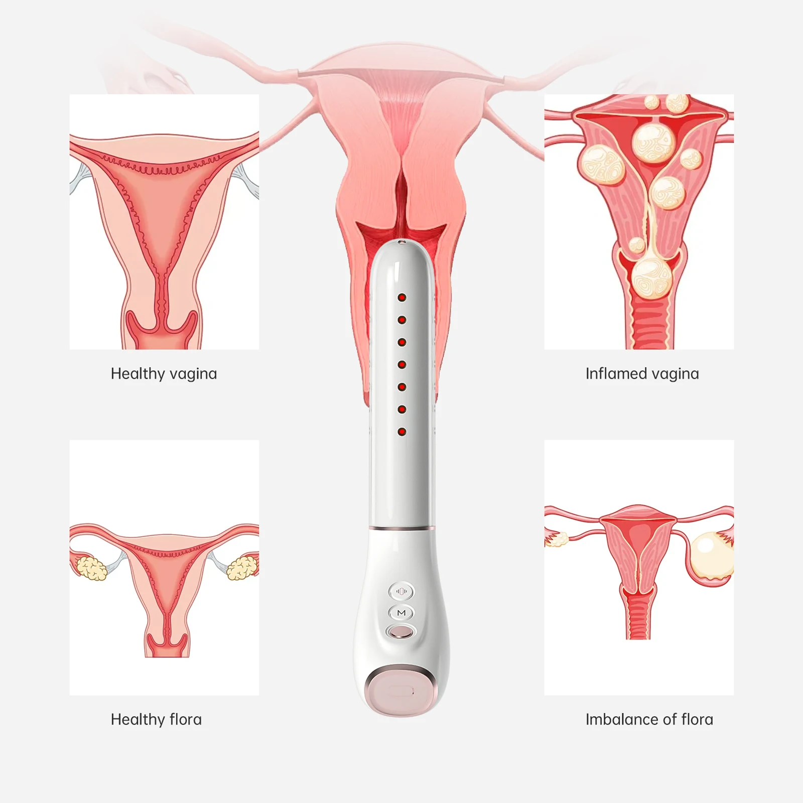 Gynecology 650nm Low Level la ser Vagina Therapy Device Vaginal Rejuvenation Wand