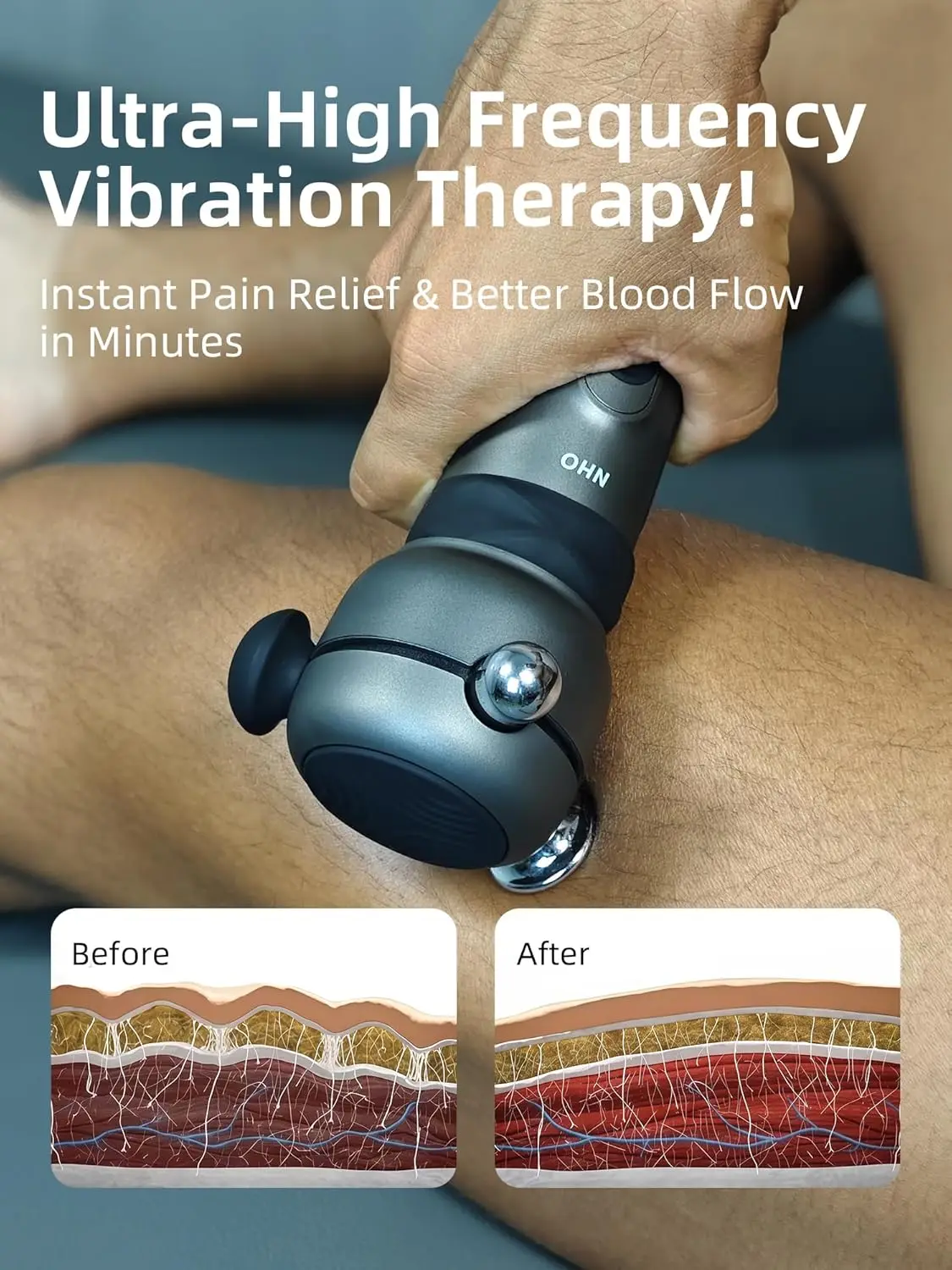 Рисунок 4 - Пистолет для выпуска NHO