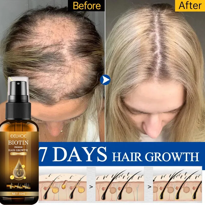 Biotin Fast Hair Growth Serum Spray Anti Hair Loss Essential Oil Prevent Baldness Treatment Scalp Beard Repair Hair Care Product