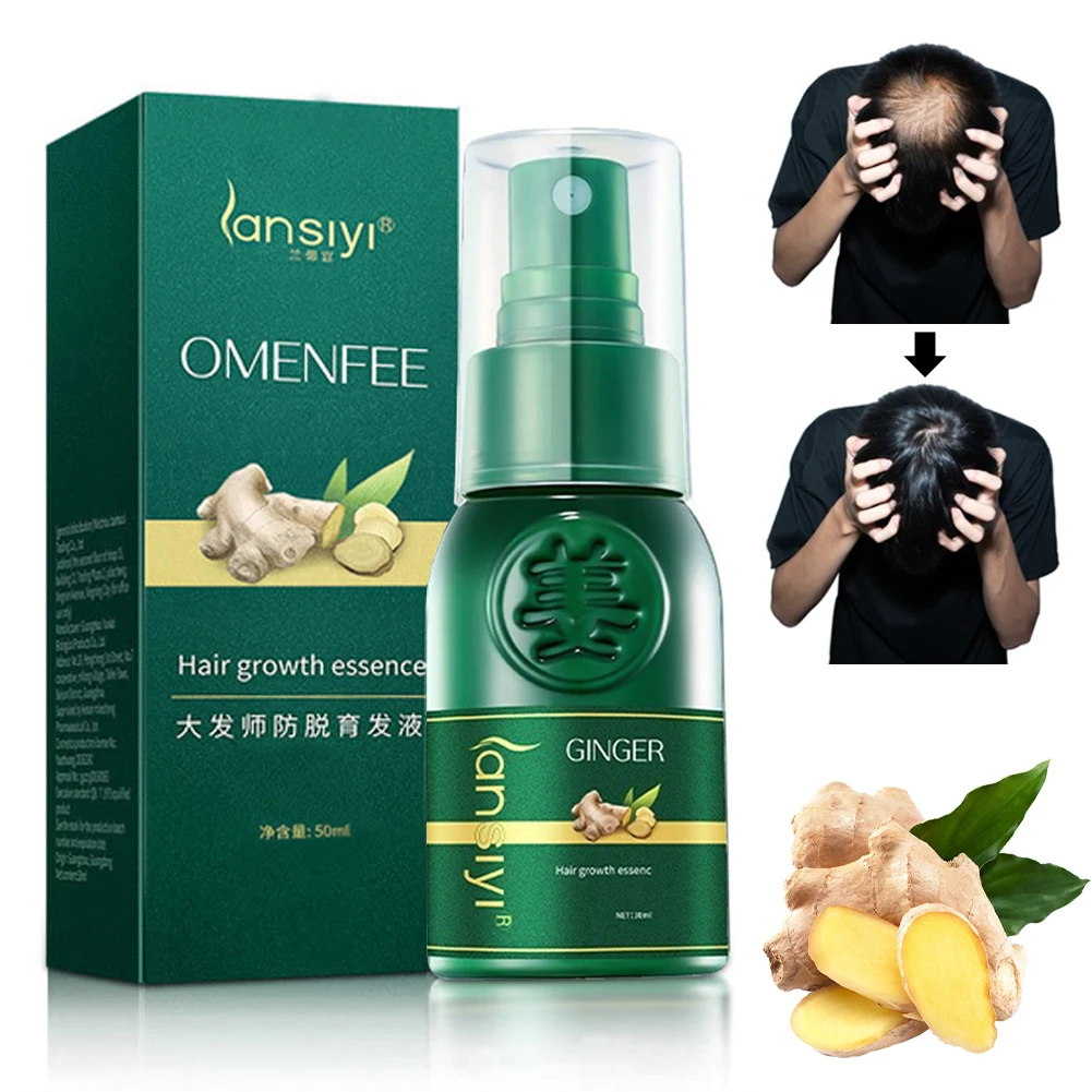 

Имбирный спрей для роста волос, восстанавливающий кожу головы и эффективный спрей для утолщения волос, фотоспрей для роста волос, 30 мл