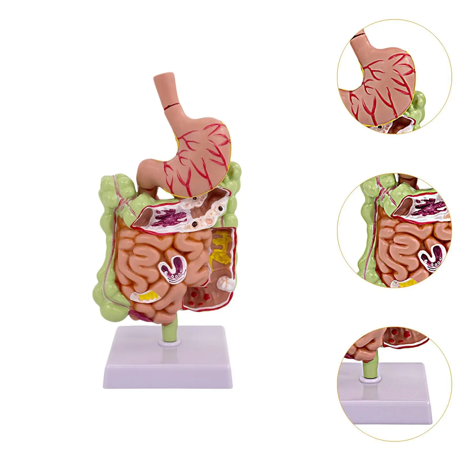 Modelo de anatomía del estómago humano, sistema patológico de PVC para exhibición de estudio, Educación, Oficina, demostración en el aula