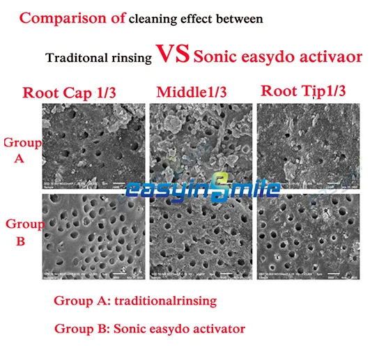 Easyinsmile Endo Activator Dental Sonic Irrigator Endodontica Odontológico Root Canal cement Bioceramic Sealer Composite Filling