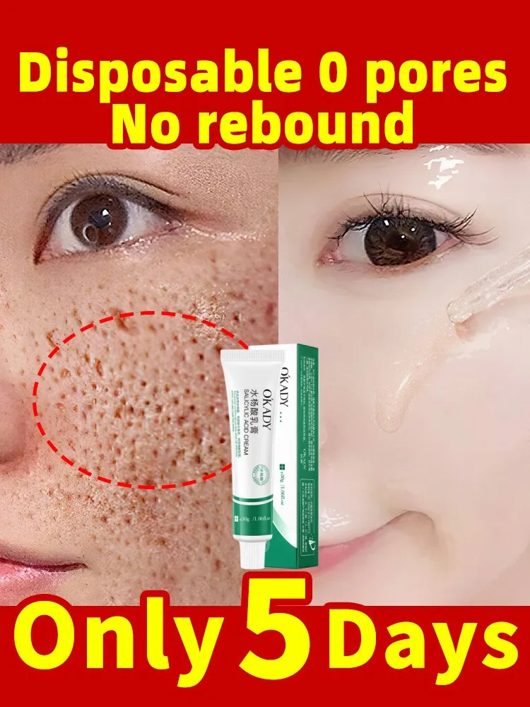 5 Days Powerful Shrink Pores Cream Blackhead Removal Acne Treatment Scar Removal Oil Control Anti-Aging Whitening Moisturize