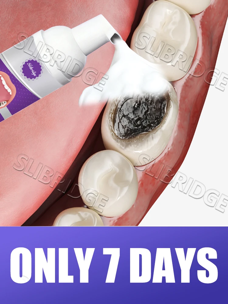 

2025 hot sale cleaning,solves various problems Intraoral care tools,Free shipping