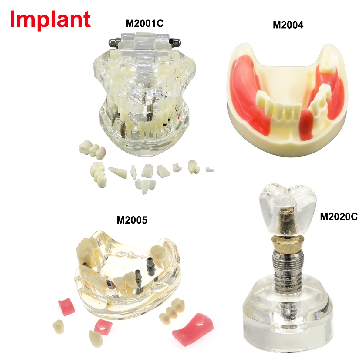 Modelos dentales de varios tipos, modelo de enseñanza Dental para entrenamiento, estudiar implante de ortodoncia, material de odontología