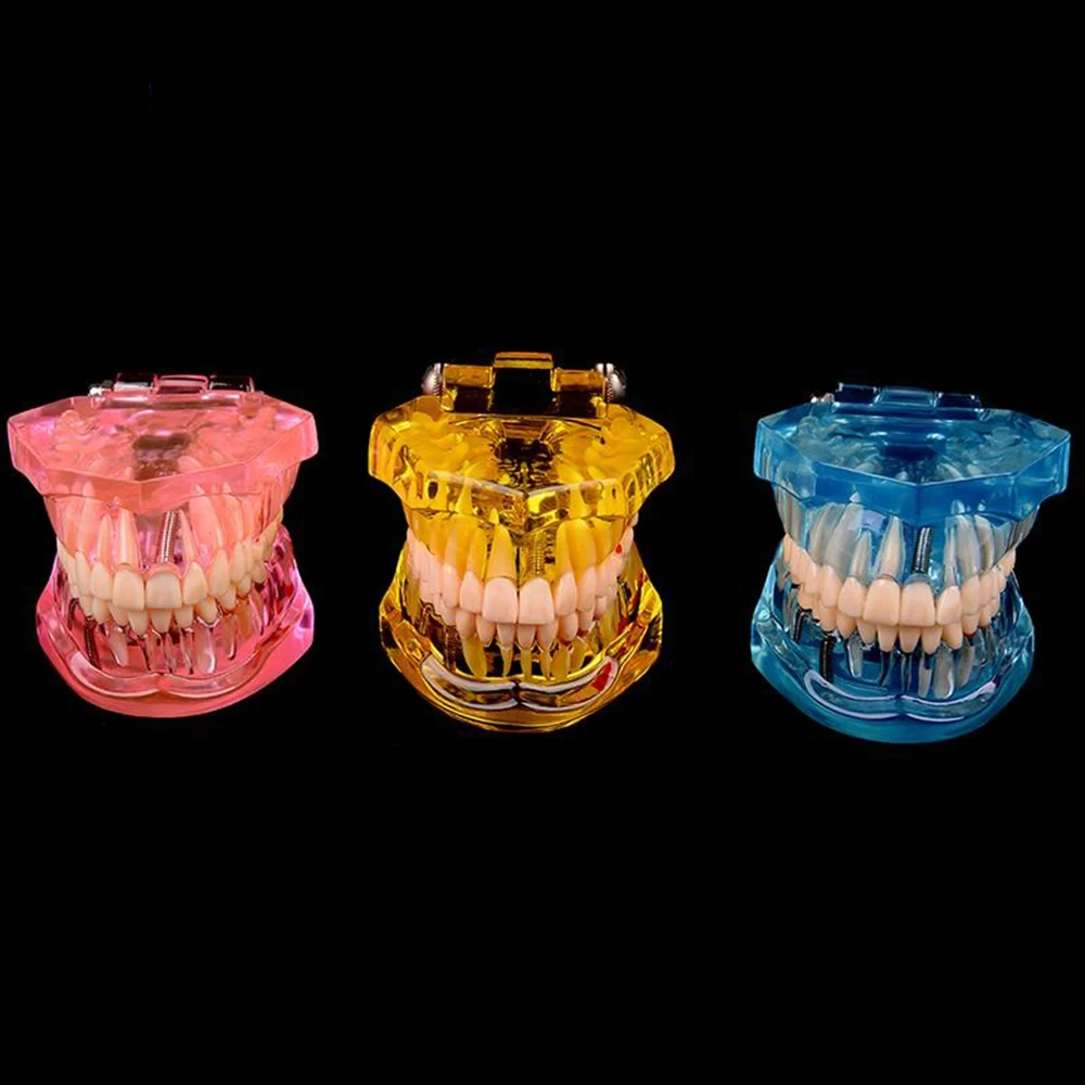 Thumbnail 4 - #11 Dental Teaching Models List of Top Picks