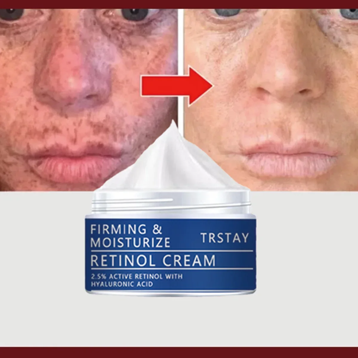 كريم وجه TRSTAY Retinol 2.5% لشد وترطيب نشط مع حمض الهيالورونيك وتبييض البشرة للعناية بالأمومة #5