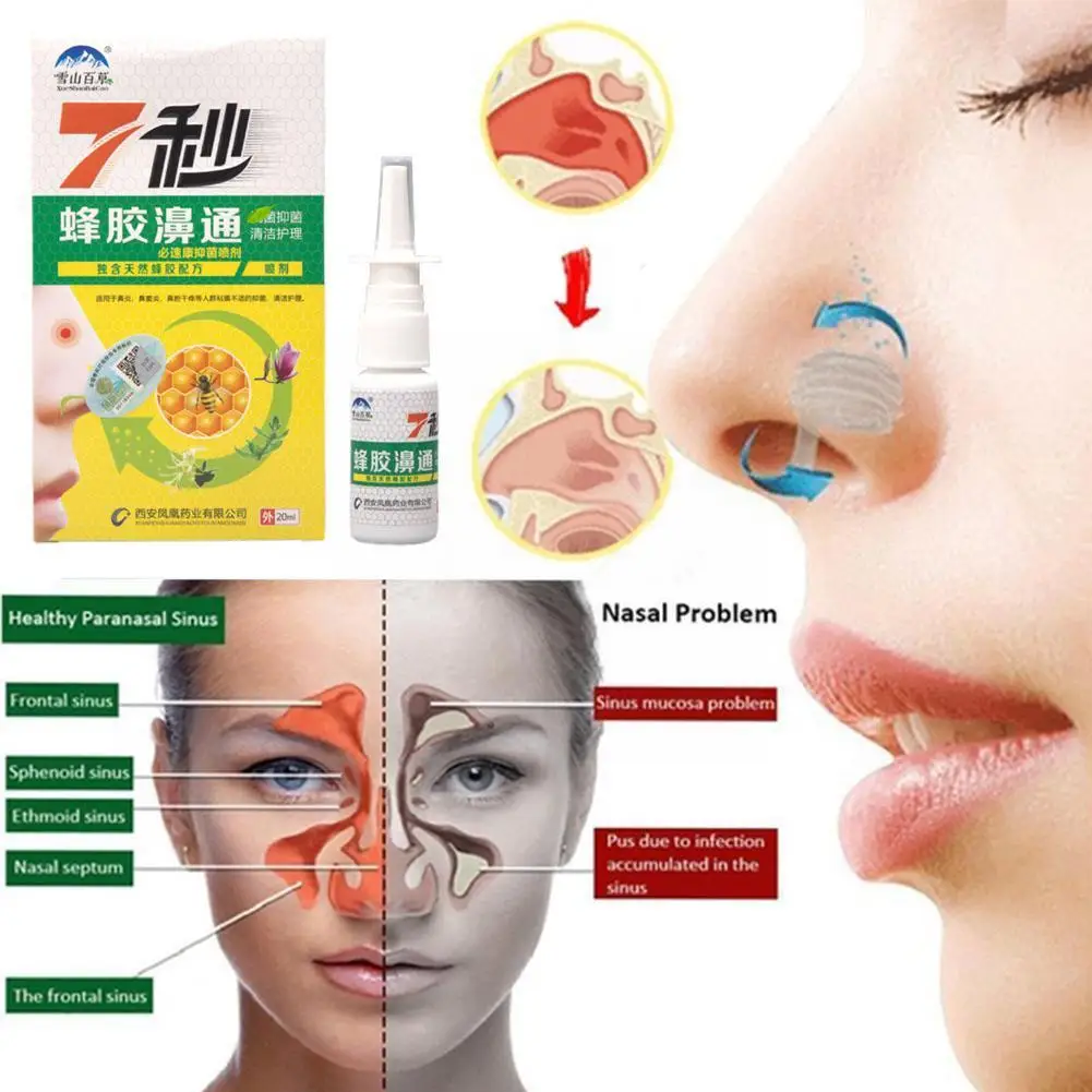 Propolis Extract Nose Spray To Relieve Nasal Discomfort Rhinitis Nasal Allergic Health Itching Nose 2023 Drops New Runny K3H3