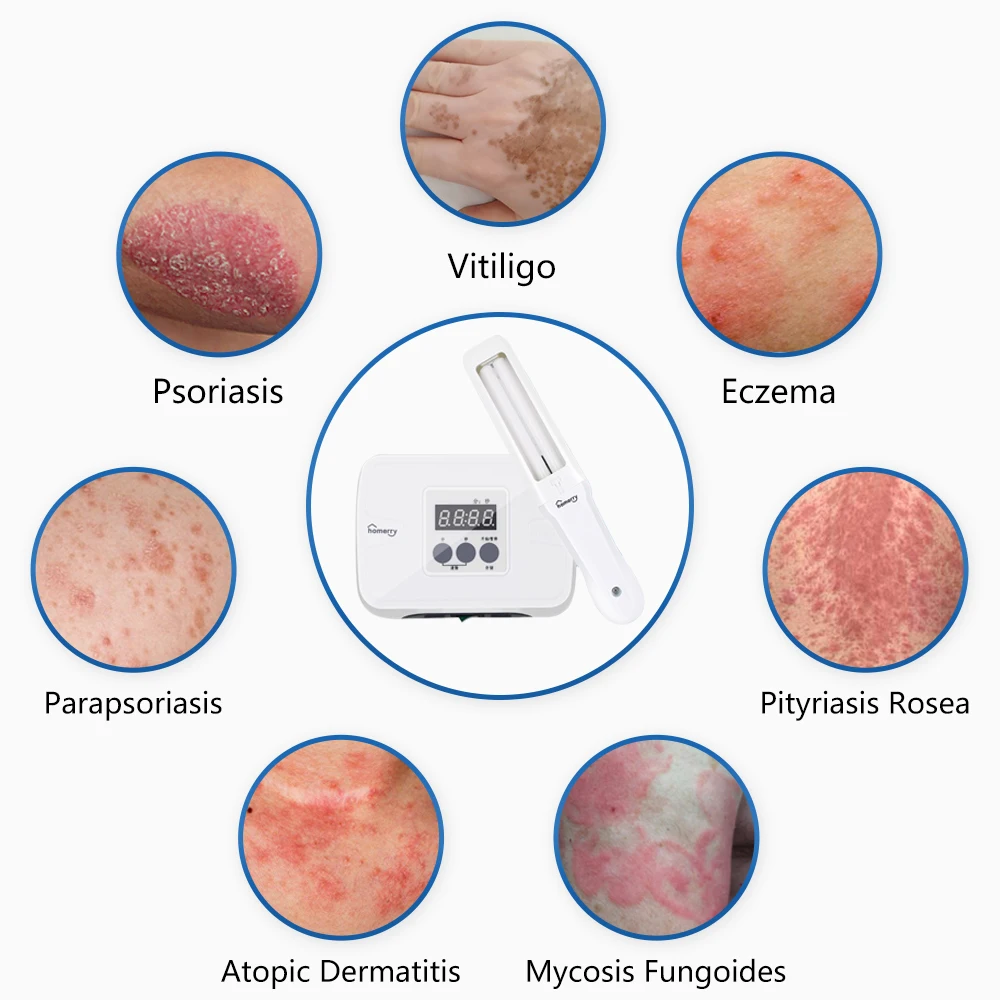 

NEW Top Quality 311nm Narrowband UVB Phototherapy Light Therapy for Vitiligo Psoriasis Treatment