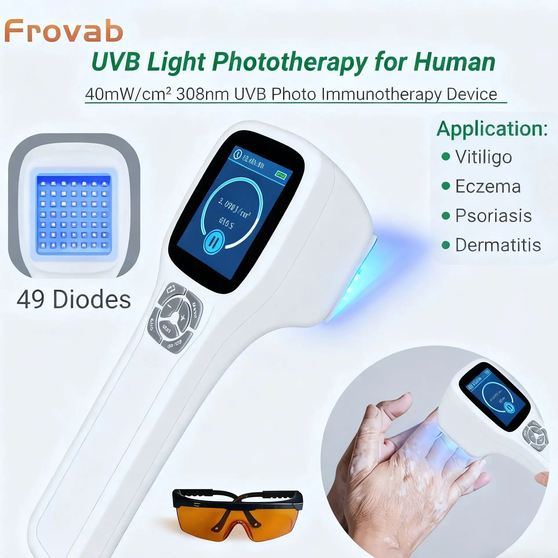 

Frovab Portable Ultraviolet Light Therapy Machine for Psoriasis Vitiligo Eczema 308nm UVB Phototherapy Lamp 49 Diodes Home Use