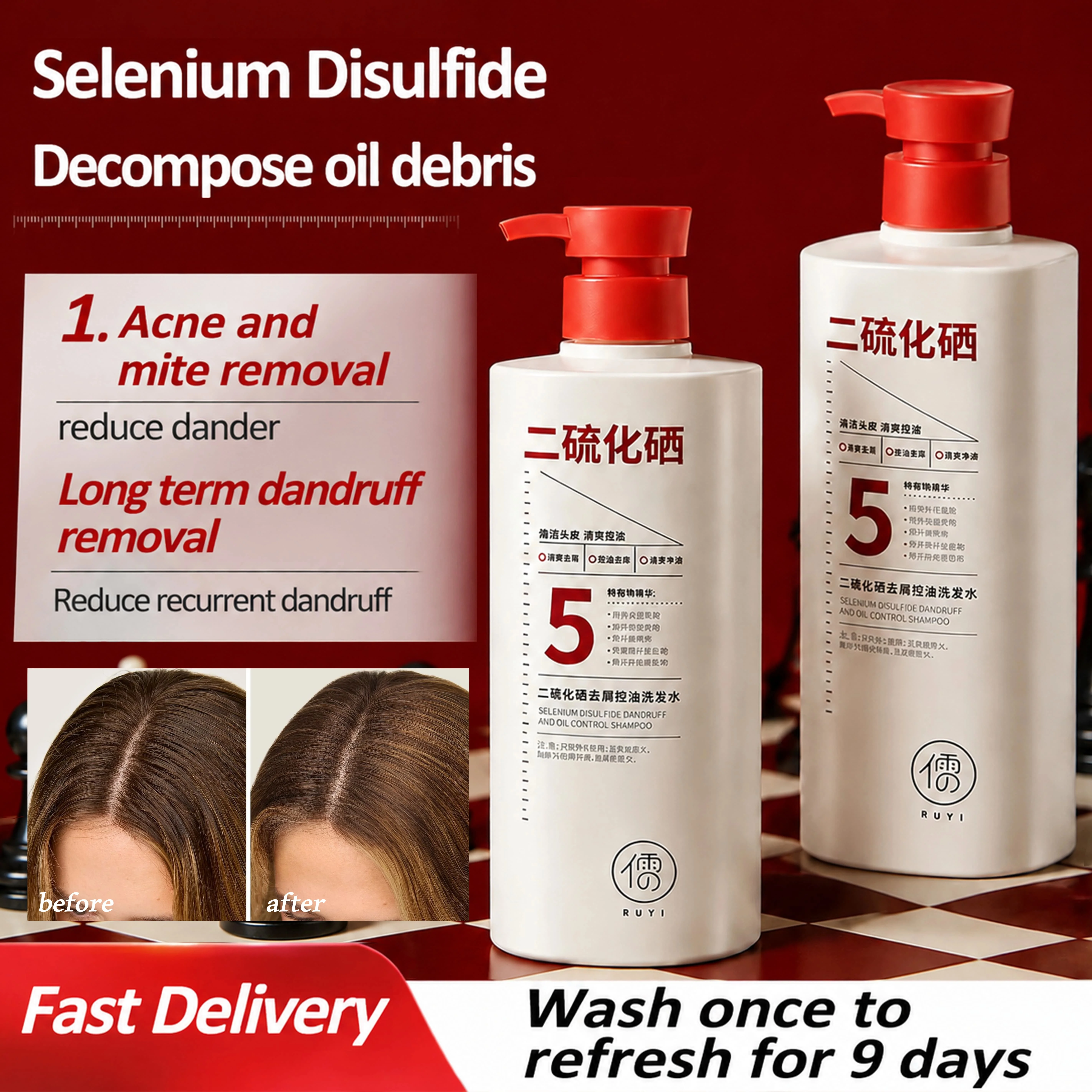 RUYI Shampoo Selenium disulfide hair follicle Cleansing anti-dandruff oil-control  volumizing shampoo lotion For women men