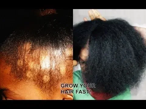 Overnight Hair Growth Serum, Thick Long Hair , Powerful Hair Growth Liquid Serum