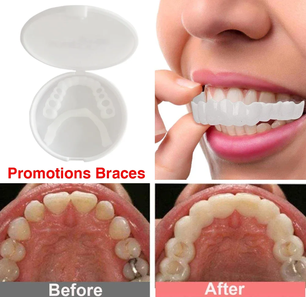 1set Perfect Fit Teeth Whitening Fake Tooth Cover Snap On Silicone Smile Veneers Upper Beauty Tool Lower Teeth Upper teeth