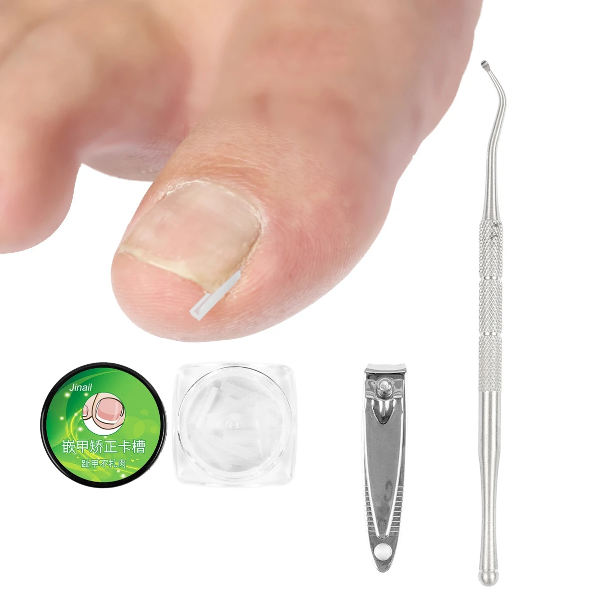 10 pezzi strumento di correzione dell'unghia incarnita trattamento delle unghie dei piedi incarniti adesivo Patch elastico raddrizzamento Clip Brace Pedicure Tool