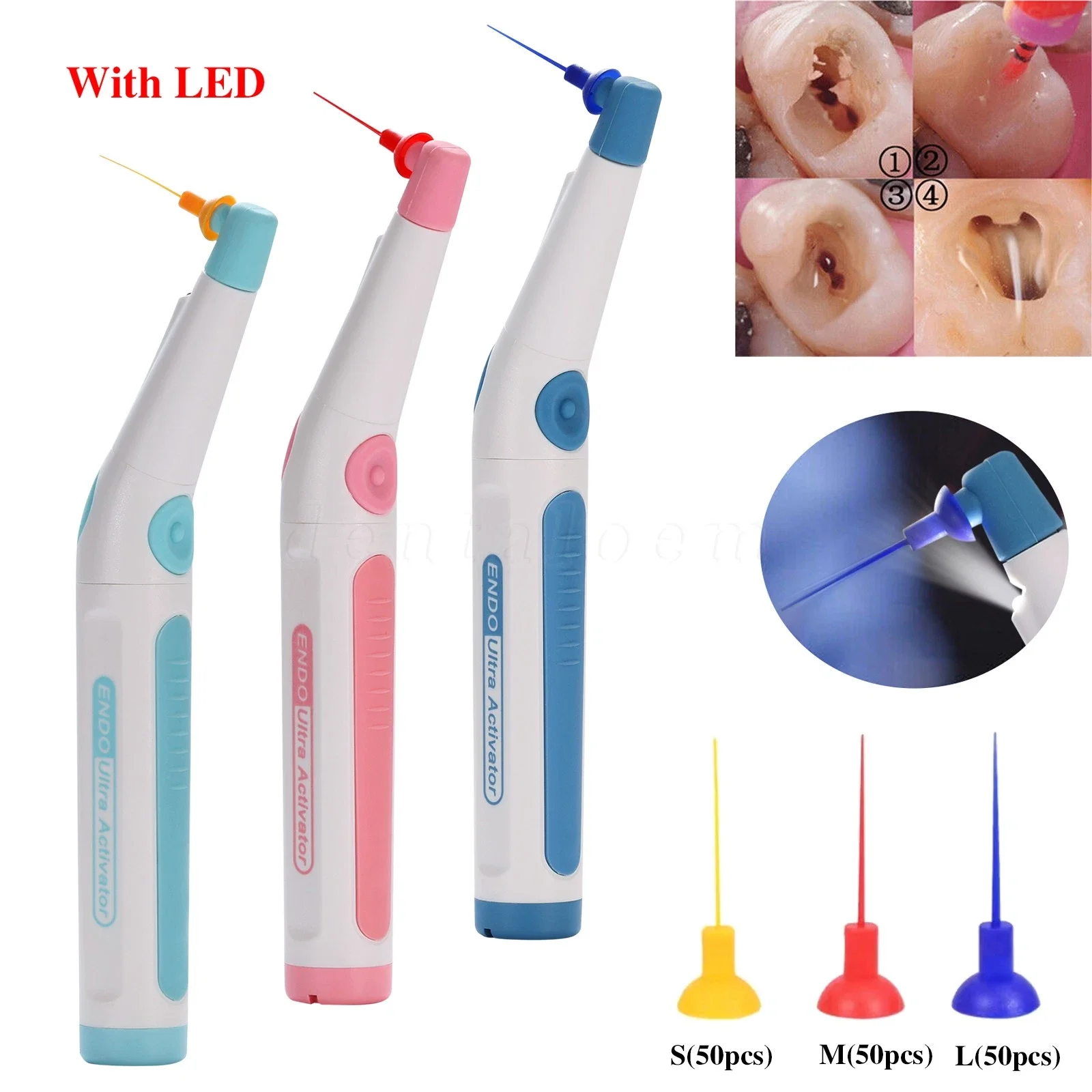 

3Colors Dental Endodontic Endo Activator Sonic Endo Ultra Irrigator Root Canal 150 Tips