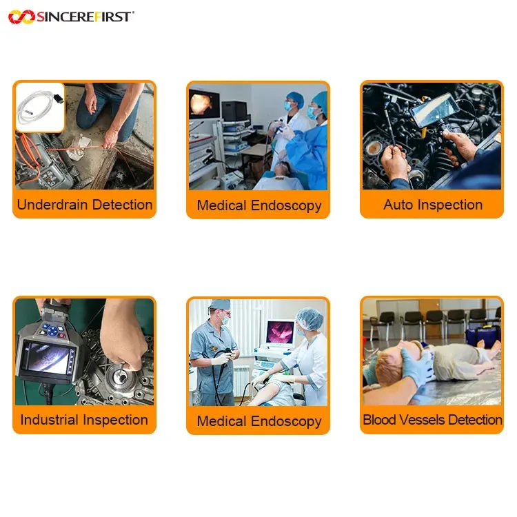 Most Cost-effective High Quality flexible endoscopy mini camera module smallest endoscope camera module medical endoscope 2mp