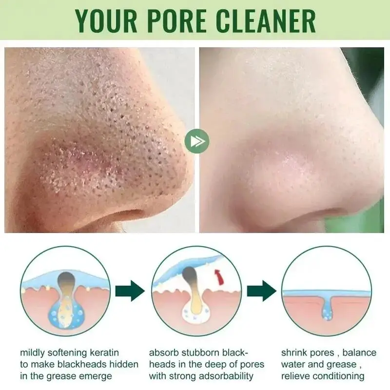 Original Facial eliminar espinillas té verde máscara sólida tratar acné imperfecciones puntos negros palo limpio crema encoge los poros cuidado de la piel ﻿