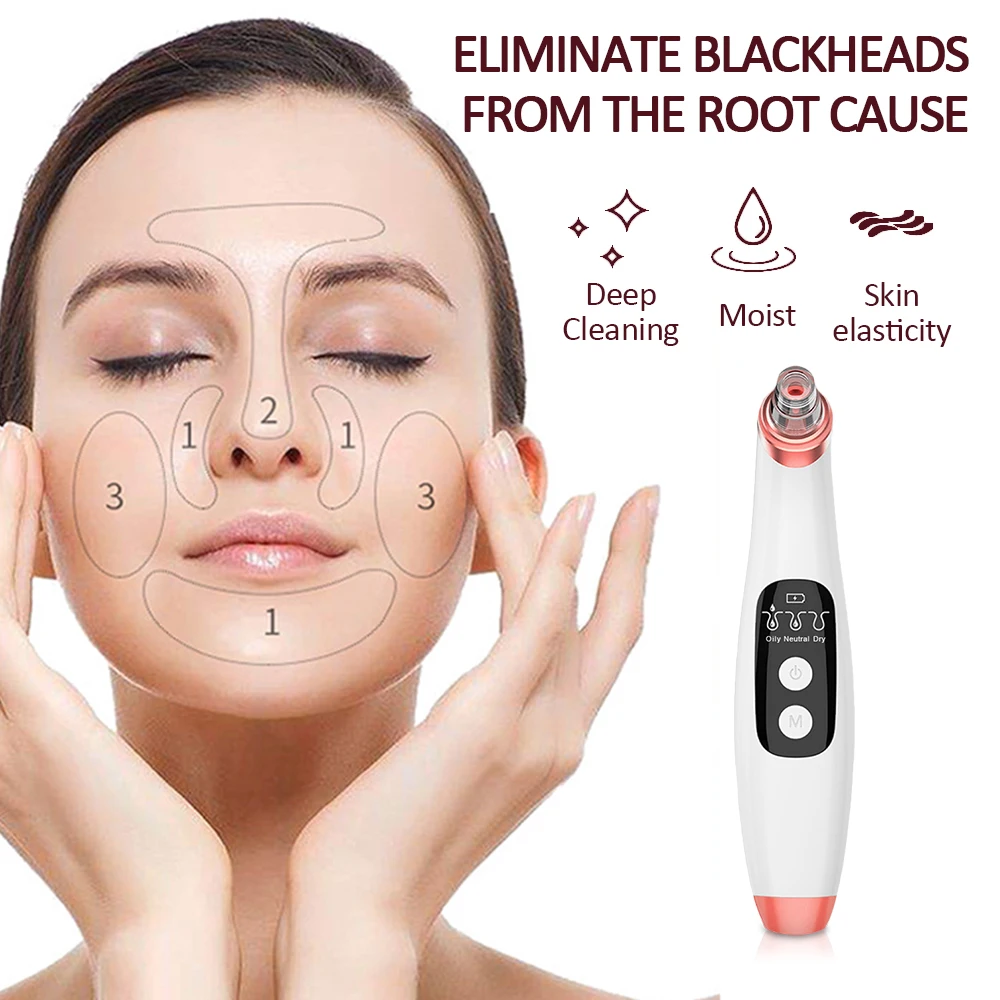 Visuele poriereiniger 20-x vergroting Zuig Facial Comedo Acne Extractor Tool Mee-eterverwijderaar Vacuümcamera