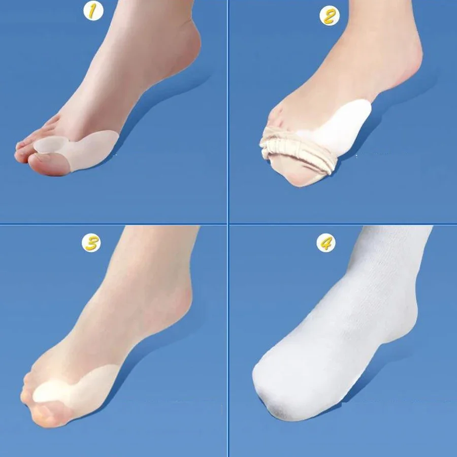 Silicone Gel Bunion Splint Big Toe Separator Overlapping Spreader Corrector Hallux Valgus Foot Care Tool Corrector De Juanetes