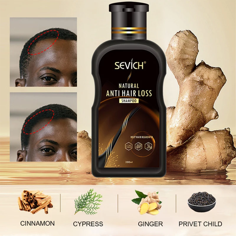 Sevich  Anti-Hair Loss Ginger Hair Shampoo 200ML Anti-Breakage Strong Hair Roots Hair Loss Treatment Shampoo