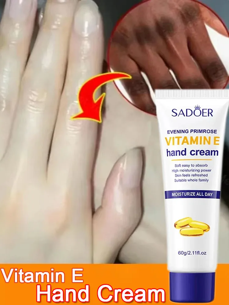 Clareador creme para as mãos removedor de rugas anti-rachadura hidratante esfoliante reparação loção para as mãos anti-envelhecimento nutrir cremes de cuidados com a pele