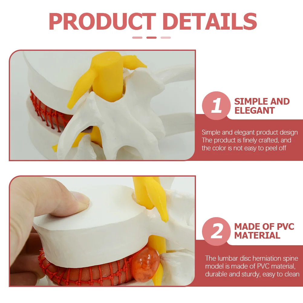 Intervertebral Disc Model Lumbar Herniation Teaching Models Spine for Learning Vertebrae Degenerative Pvc