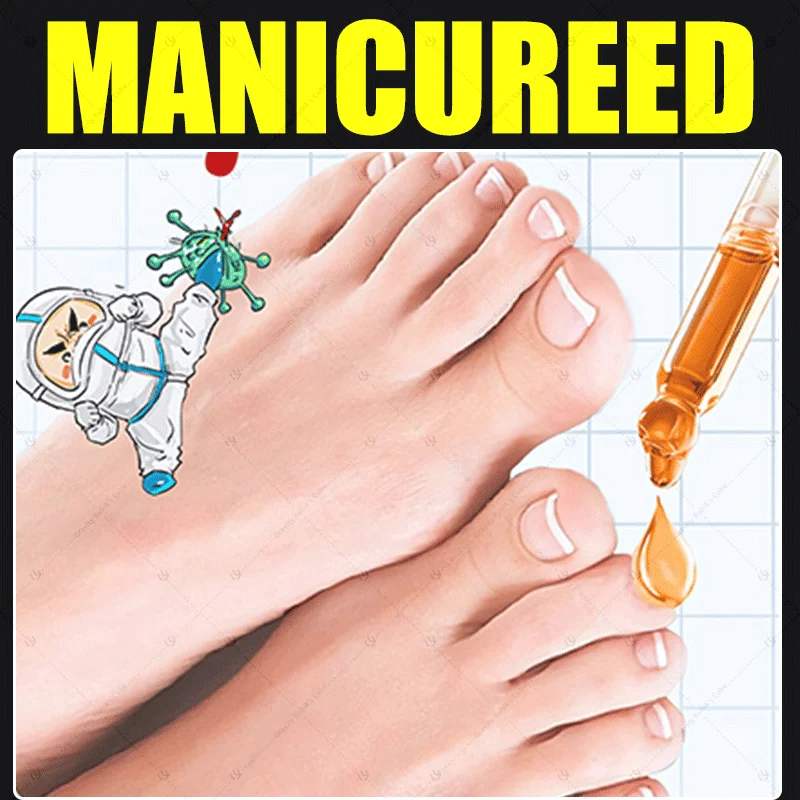 MANIKÜRE FÜR SCHLECK KANN IN 7 TAGE FAREWELL