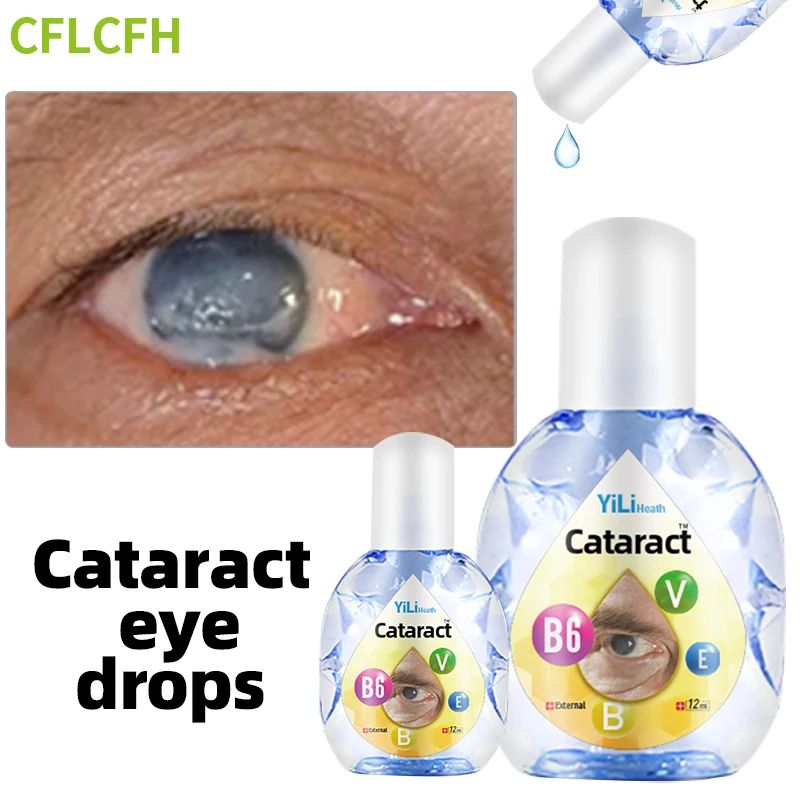 Cataract Treatment Eye Drops with Vitamin B6 for Cloudy Eyeball and Dry Eyes Blurred Vision Black Shadow Removal Medicine 12ml