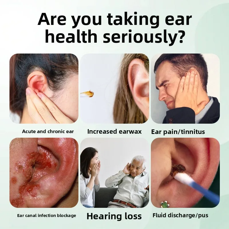 بلسم مريح للأذن لتخفيف طنين الأذن والحكة يهدئ الرنين والانزعاج والعناية اليومية على أساس نباتي #2