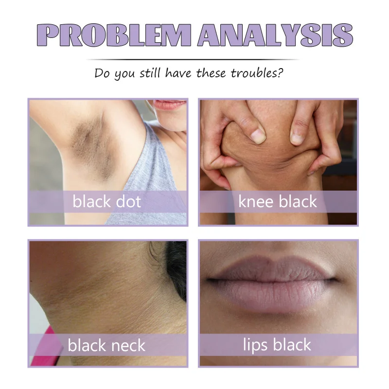 كبسولات وألواح فيتامين الناعمة توفر الرطوبة ويغذي العناية بالأعصاب وتحسين النوم وتخفيف النوم #3