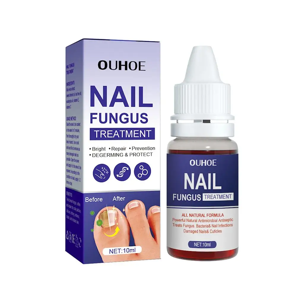 Tratamento do fungo para unhas, Reparar unhas dos pés, Onicomicose Paroníquia, Anti Infecção, Toe Nail Remoção de fungos, E9h3