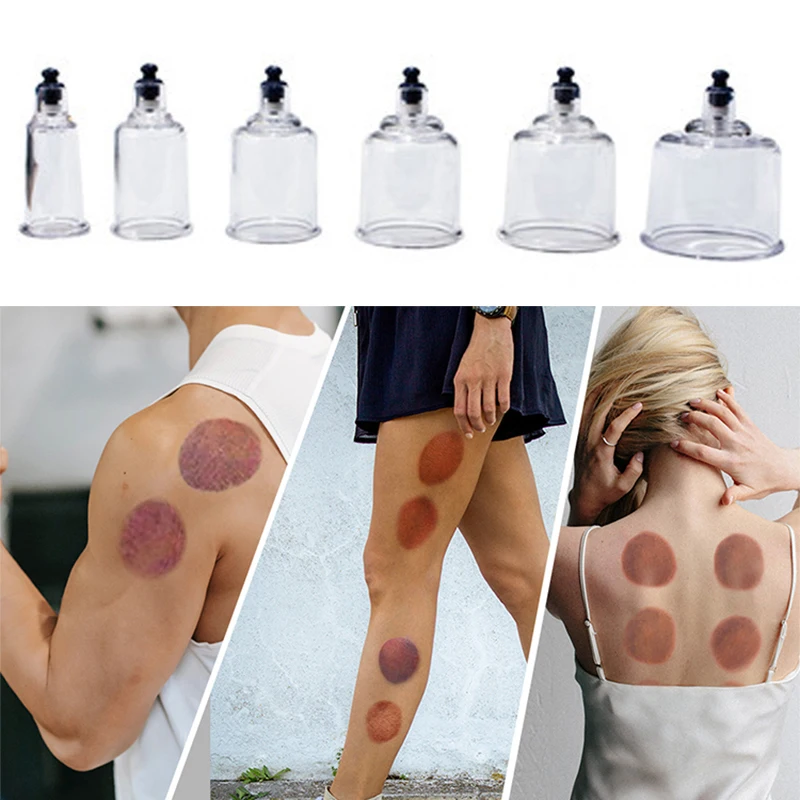 17 Cans Vacuum Cupping Therapy Set Plastic Vacuum Cups Massager Medical Suction Cups Jars Therapy Cupping Set for Massage