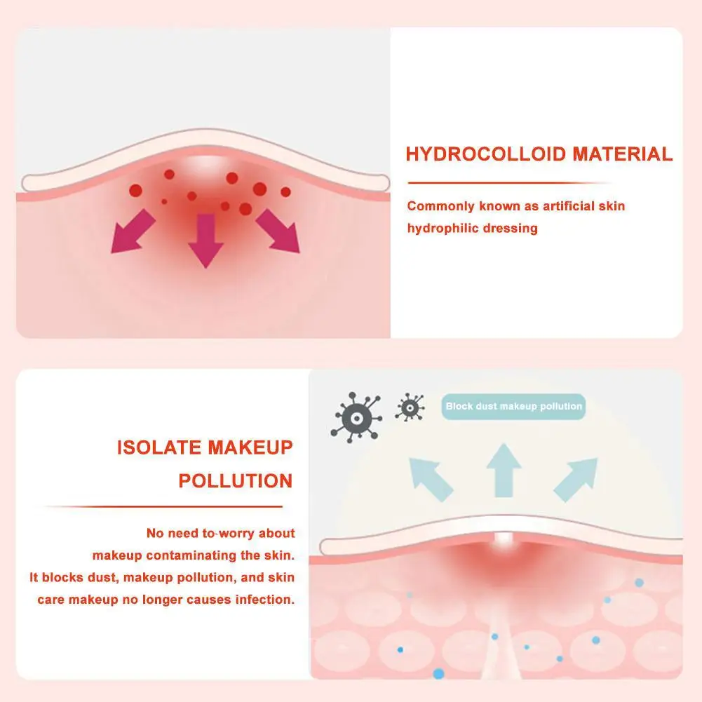 Contiene parches coloridos para espinillas y mariposas, pegatinas para tratamiento del acné, cubierta Invisible para acné, parche para espinillas y manchas faciales, cuidado de la piel