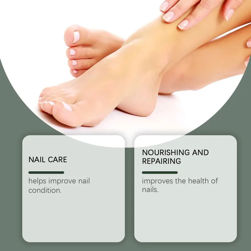 60ml Tea Tree Ginger Nail Fungus Care Solution Health Maintenance Repair Discoloration Thickening Hand Foot Nail Treatment E - view 4