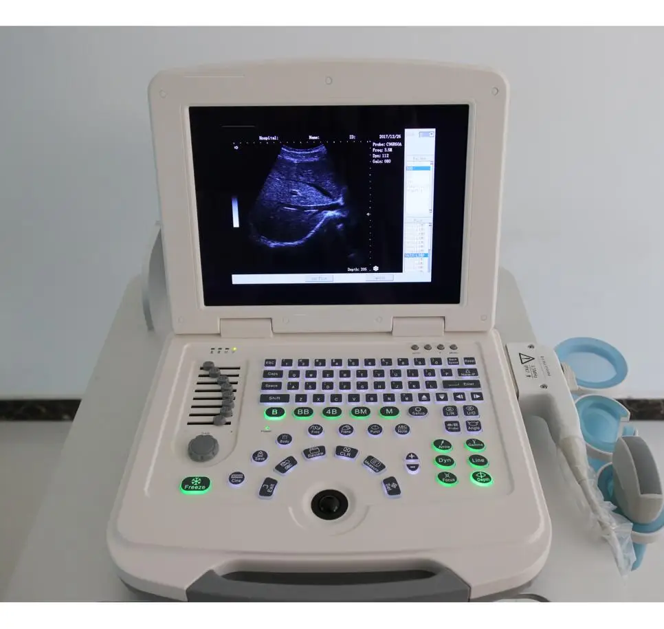 Portable ultrasound vet machines msk ultrasound machine obstetric for ob equine ultrasound machine