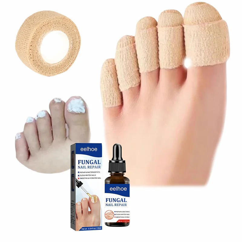 Pilznagellack, Nagelbeschichtung, Zehenschutz, Fuß- und Fingerschutz, selbstklebende Bandage, Zehen- und Fingerschutz