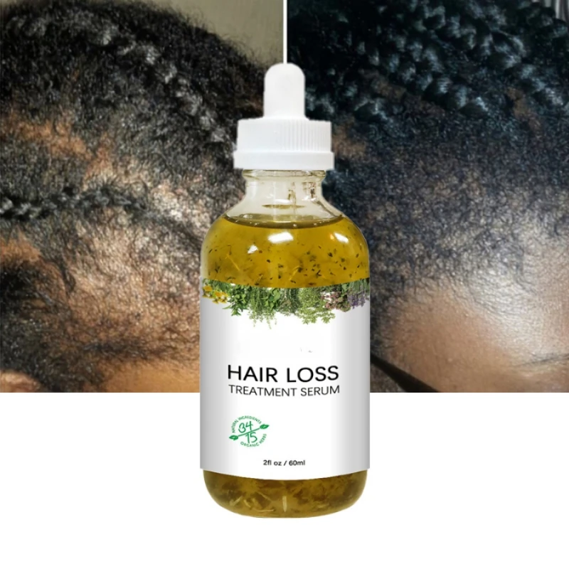 

New Fast Hair Growth Serum African Crazy Regrowth Traction Alopecia Hair Loss Prevent Edges Bald Spot Thinnin Hair Treatment Oil