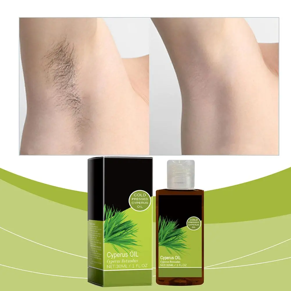 Natural Herbal Cyperus Oil For Hair Removal Reducing Redness Armpit Legs Arms Body Inhibitor Repair Beauty Skin Care D7C9