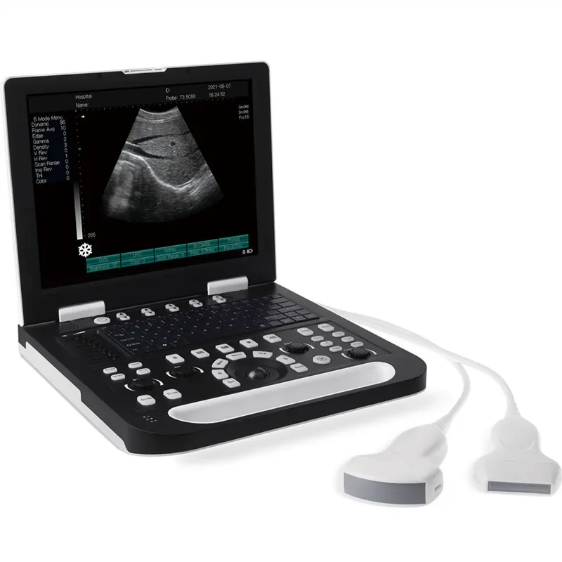 15 Inches Portable Ultrasound Machine B&W Full Digital Laptop Ultrasound System Human and Animal Use