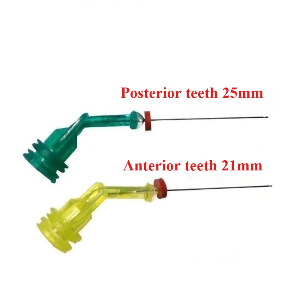 100 قطعة الأسنان عن طريق الفم المتاح بالمنظار شطف إبرة نهاية مغلقة الجانب قطع من جانب واحد الثنائي مفتوح قناة الجذر شطف إبرة