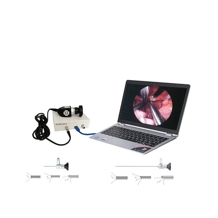 medical mini smart usb cameraS portable video cameraS with 70 degree laryngoscope endoscope