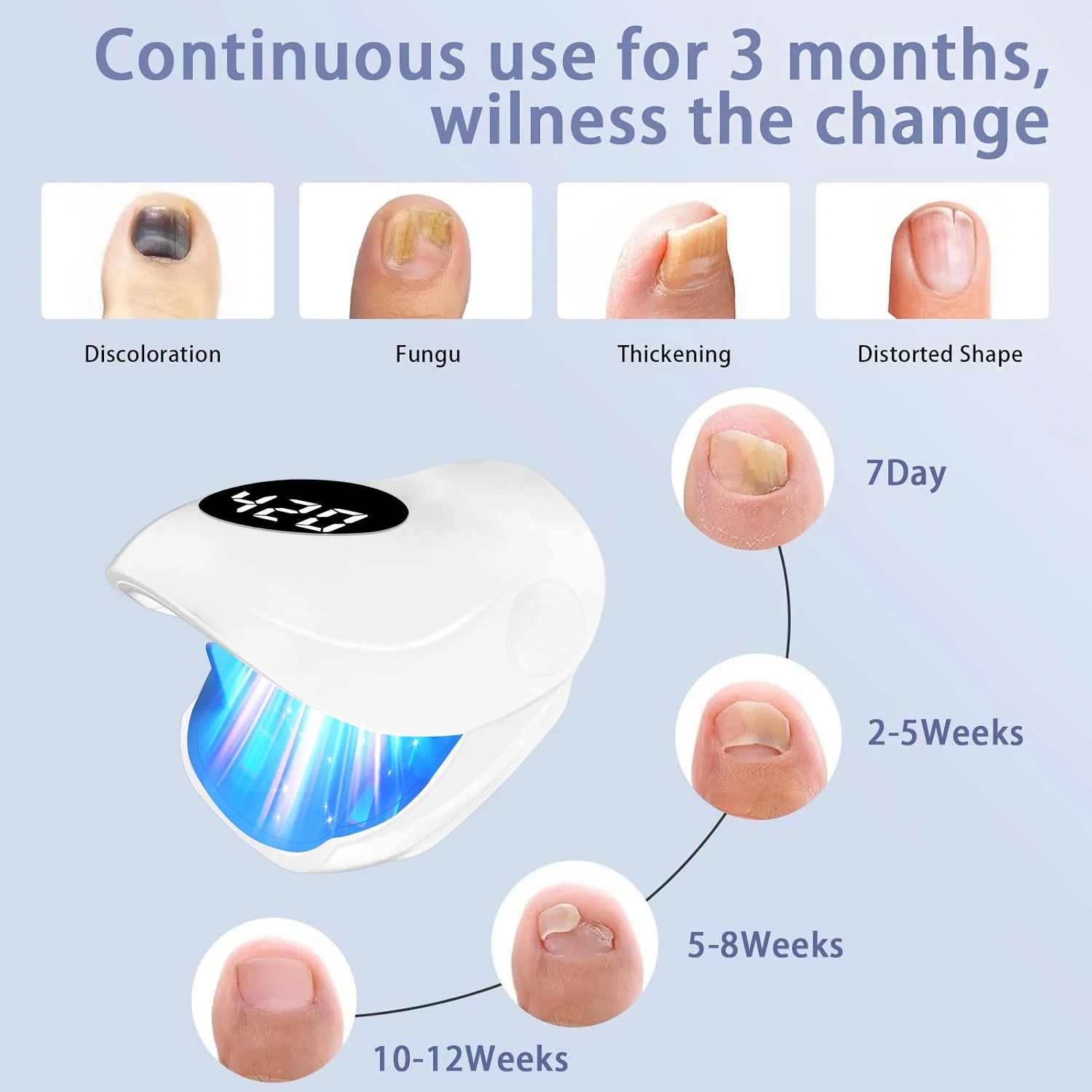 Thumbnail 3 - #25 Cheapest Skin Care Tools Deals You Can Get