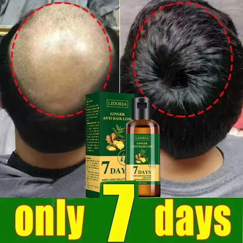 Hair Growth Serum 7 Days Fast Regrowth Essential Capsule Anti Hair Loss Baldness Repair Damaged Scalp Treatment For Women Men view 3