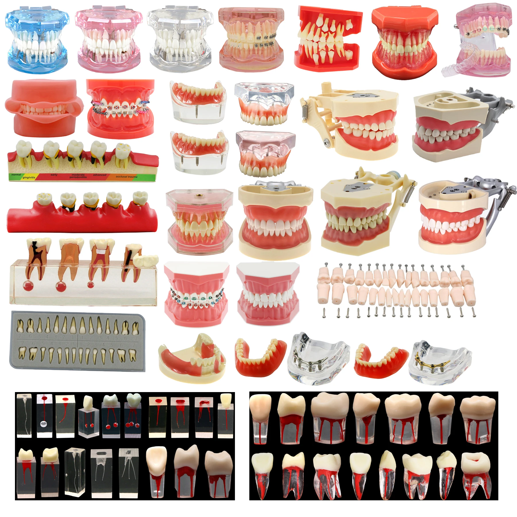 Dental Teeth Model Teaching Standard Implants Models Orthodontic Dentistry Dentist Demo Kilgore NISSIN 200/500,AG3,Columbia 860