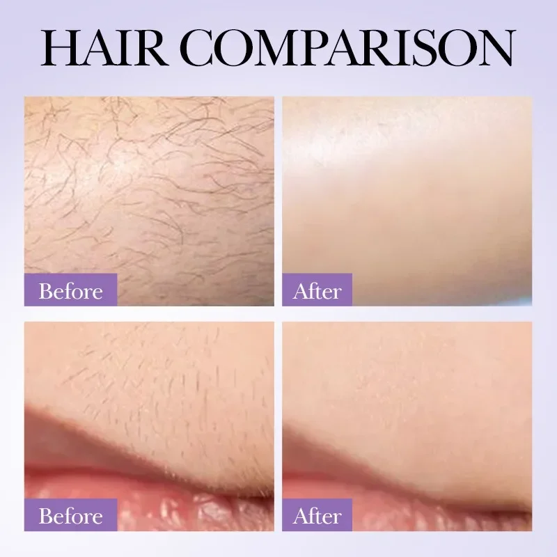 

Ant Essence Hair Care Spray and Hair Growth Inhibiting Serum Depilatory Solution Hair Removal Cream suppression Products