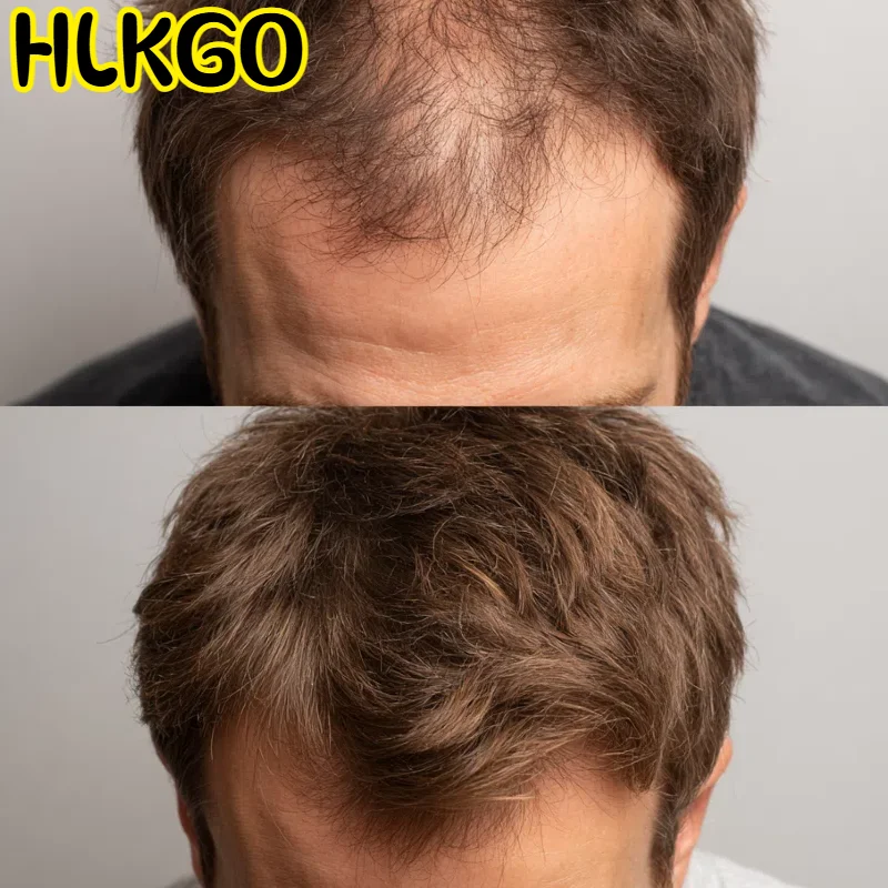 

Сертифицированная CE 96 лазерная шапочка для роста волос 650 нм 5 мВт для лечения роста волос и кожи головы