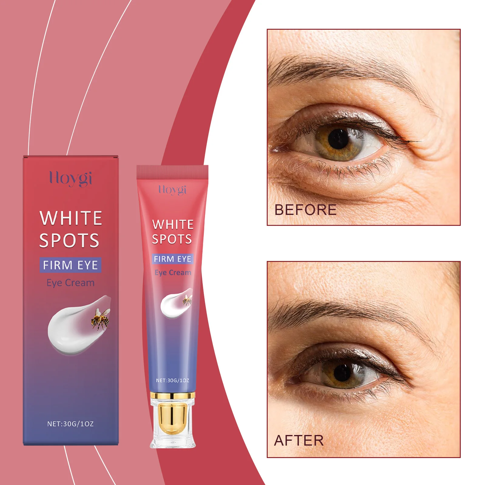 Eye Cream for White Spots & Dark Circles - Iloygi Firming Eye Treatment, Anti-Aging, Brightening, 30g